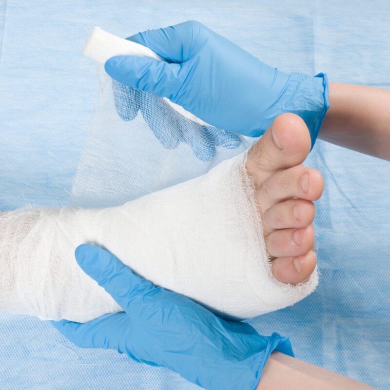 A foot being bandaged for a wound