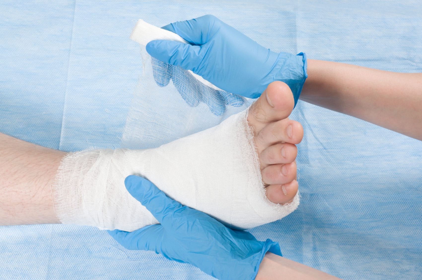 A foot being bandaged for a wound